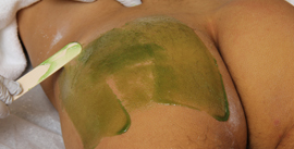 Hot wax application during body waxing — Male Brazilian Waxing NYC
